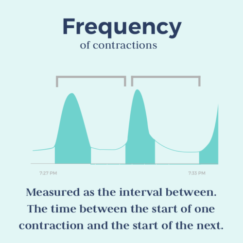 timing-contractions-what-you-need-to-know-bloomlife