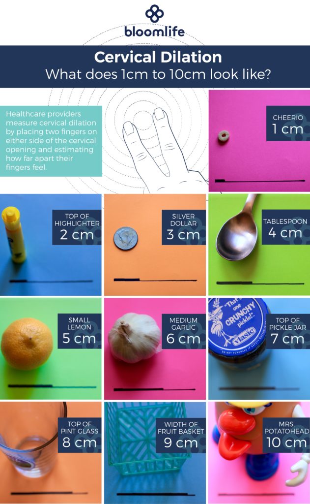 Contraction Chart In Hospital