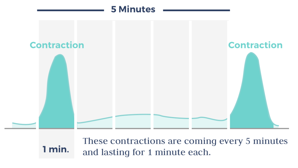 timing contractions