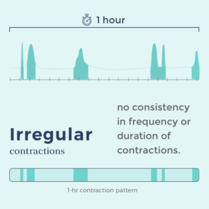 contraction timing
