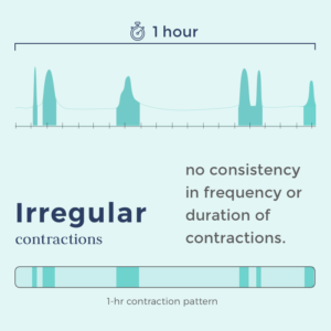 timing contractions