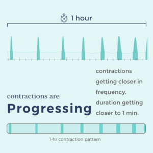 tracking contractions