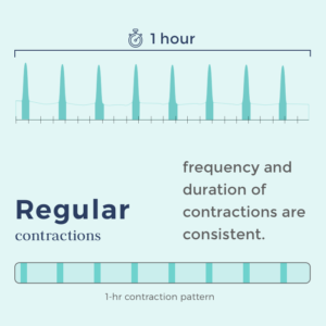 real contraction timing