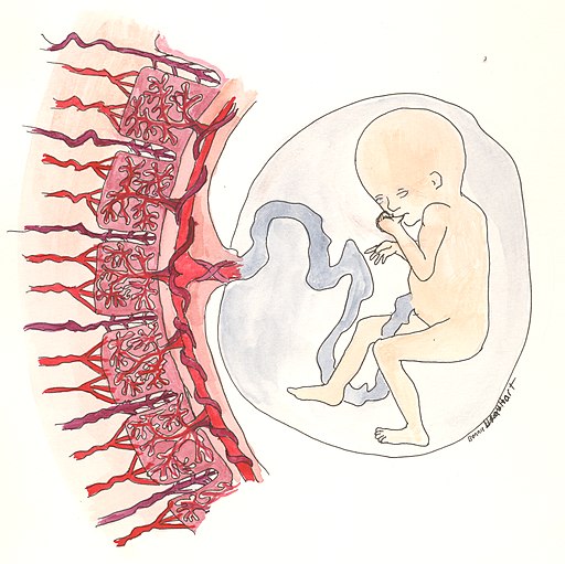what is preeclampsia causes placenta formation